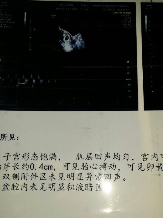 艾叶红花泡脚的功效