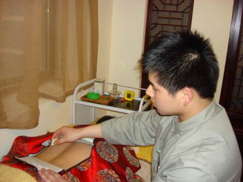 艾灸师