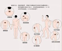 艾灸贴的使用方法图解