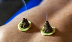 艾条的用法,艾条的功效与作用