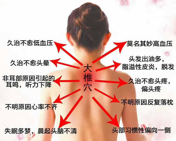 颈椎病症状