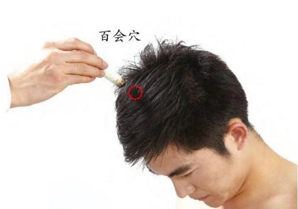 百会穴图片