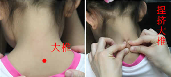 大椎穴艾灸穴位图
