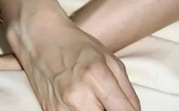 青筋暴起