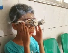 核桃灸的功效与作用 核桃灸视频