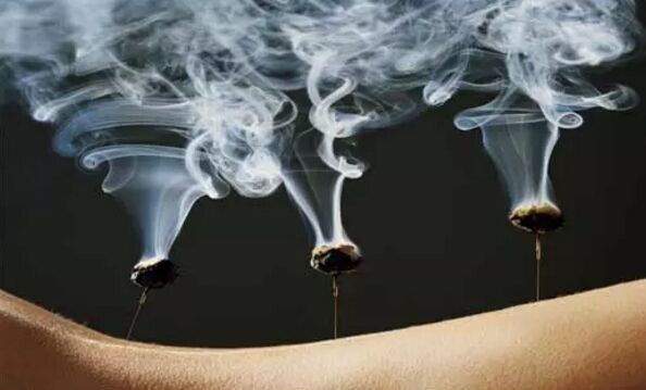 温针灸操作方法 