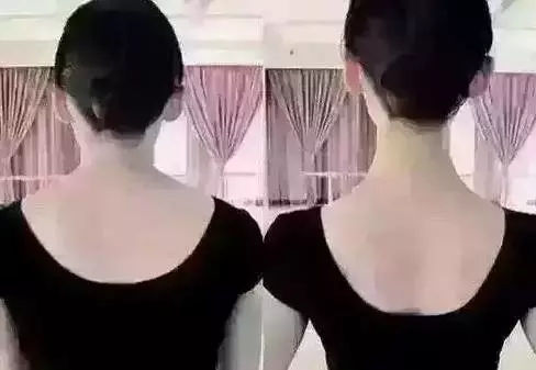 颈椎病头晕怎么办