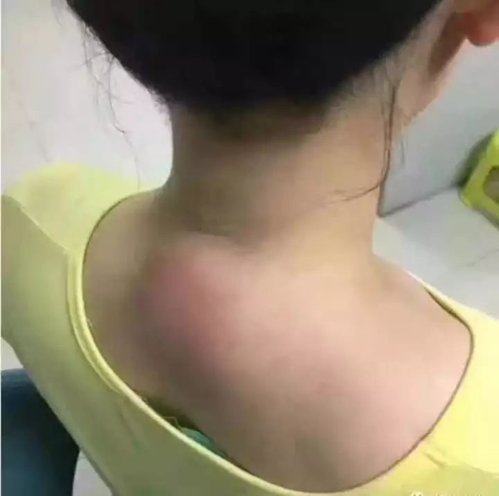 颈椎病的症状
