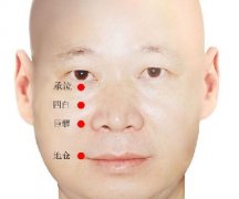 面瘫艾灸疗法,艾灸怎么治疗面瘫