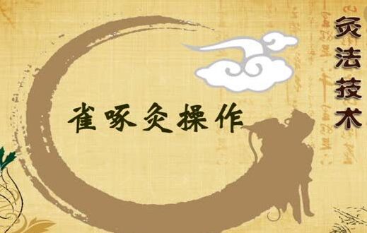 艾灸疗法操作之雀啄灸