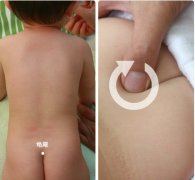 小儿推拿真人高清图解