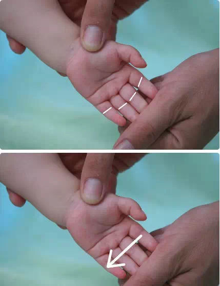 四缝