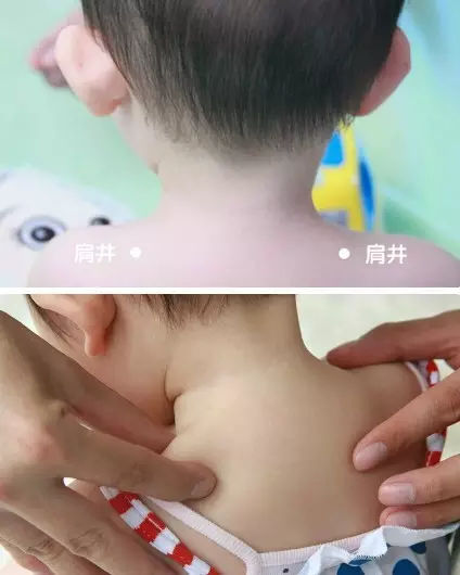 肩井膻