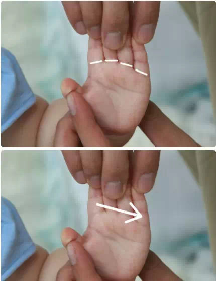 小横纹膻