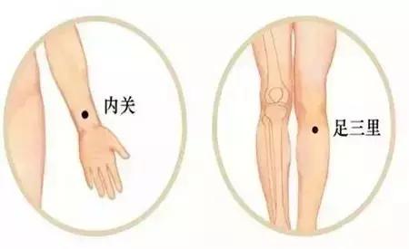 内关+足三里