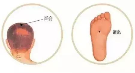 百会+涌泉