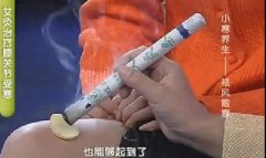 艾灸视频治疗膝盖疼