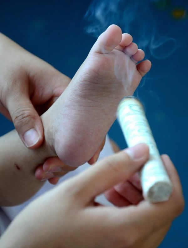 儿童艾灸穴位图