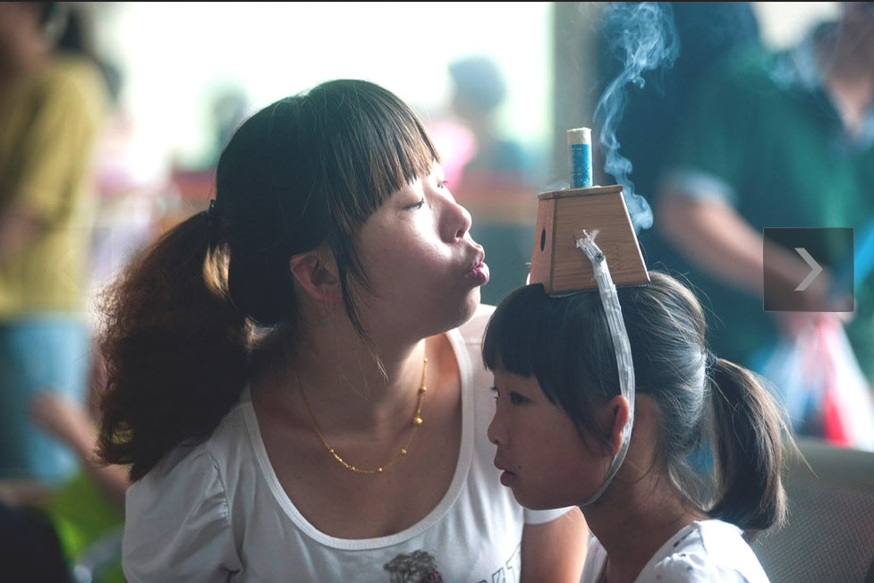 儿童艾灸穴位图