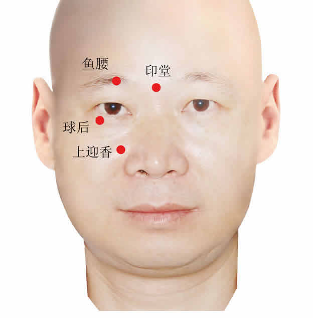 鼻炎艾灸穴位图
