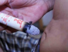 艾条熏肚脐的好处与方法