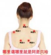 阿是穴_阿是穴位_阿是穴位置图