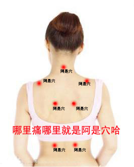 阿是穴_阿是穴位_阿是穴位置图