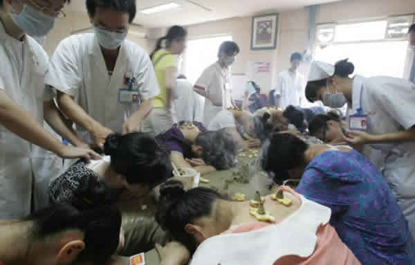 三伏天艾灸养生冬病夏治灸起来