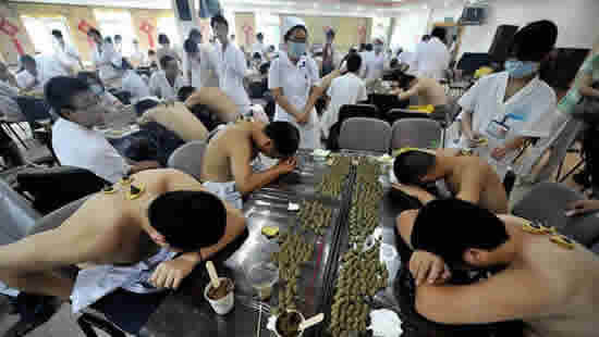三伏天艾灸养生冬病夏治灸起来
