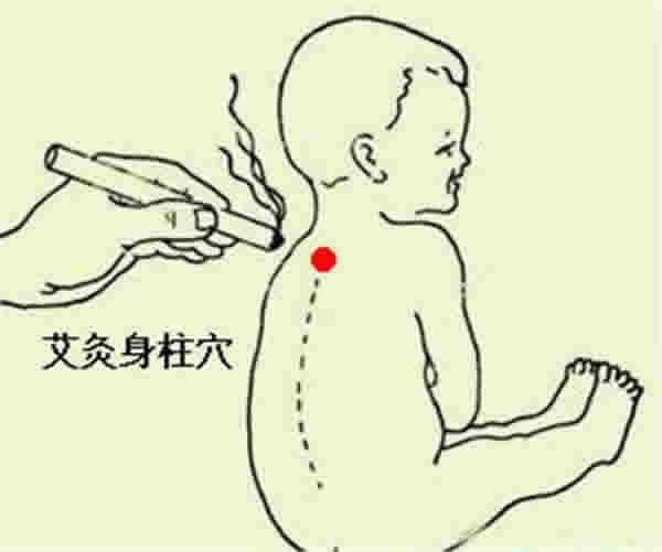 发烧艾灸哪里效果最好