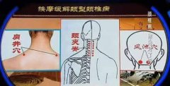 颈椎病可以艾灸吗