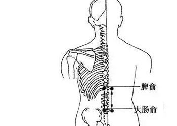 艾灸治疗便秘吗