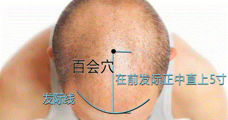 百会穴准确位置图