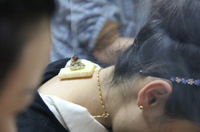 从零开始学艾灸难不难