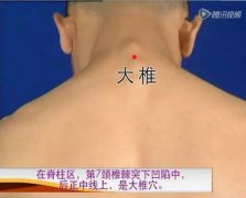 我用艾灸治好了自己的颈椎病