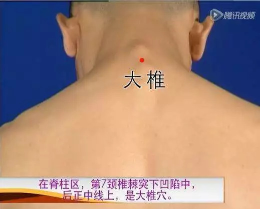 颈椎病艾灸哪里