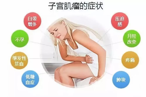 子宫肌瘤可以艾灸吗