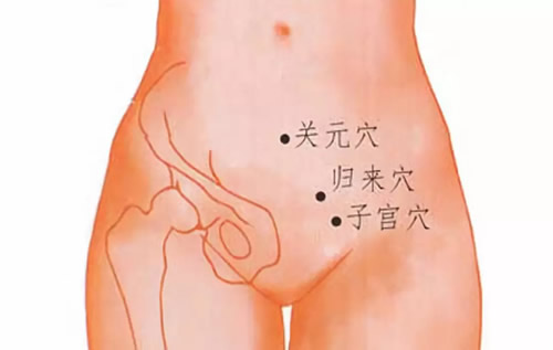 子宫肌瘤艾灸
