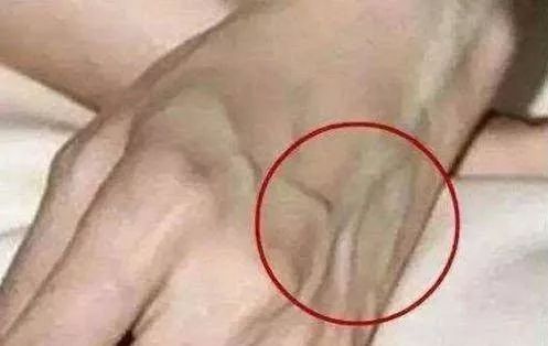 肝不好什么症状