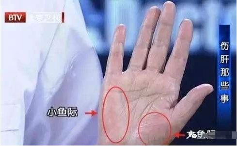 肝不好的人有什么症状