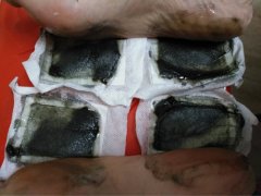 艾草足贴变黑真的排毒吗