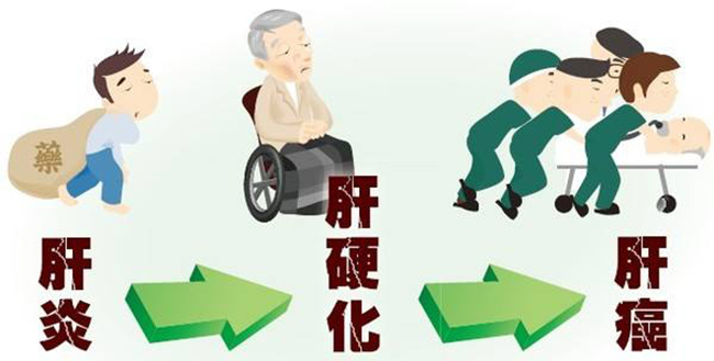 肝脏大怎么办