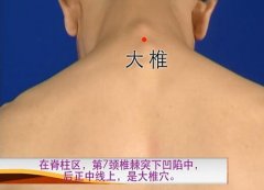 疟疾用艾灸贴哪里