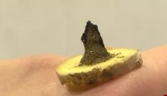 艾灸仆参穴治疗足跟痛