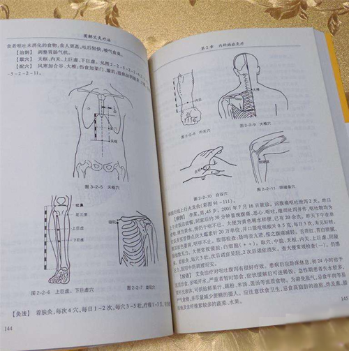 图解简易艾灸疗法