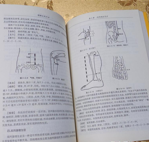 艾灸的方法图解