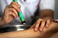 艾条灸用法类别和具体操作