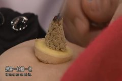 艾条熏肚脐的视频