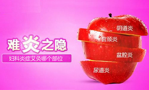 妇科炎症艾灸哪个部位