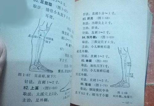 《实用常见病艾灸疗法》电子书免费下载